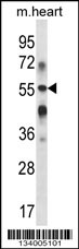 B3GALT2 Antibody (C-term) (Cat. #AP14494b) western blot analysis in mouse heart tissue lysates (35ug/lane).This demonstrates the B3GALT2 antibody detected the B3GALT2 protein (arrow).
