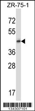 GPR137 Antibody (Center) (Cat. #AP14387c) western blot analysis in ZR-75-1 cell line lysates (35ug/lane).This demonstrates the GPR137 antibody detected the GPR137 protein (arrow).