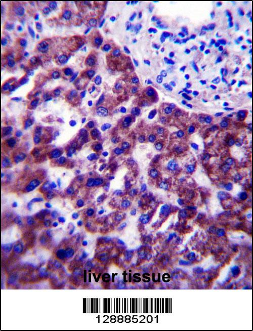 OR14J1 Antibody (C-term) (Cat. #AP14648b)immunohistochemistry analysis in formalin fixed and paraffin embedded human liver tissue followed by peroxidase conjugation of the secondary antibody and DAB staining.This data demonstrates the use of OR14J1 Antibody (C-term) for immunohistochemistry. Clinical relevance has not been evaluated.