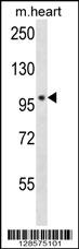 POLN Antibody (C-term) (Cat. #AP14647b) western blot analysis in mouse heart tissue lysates (35ug/lane).This demonstrates the POLN antibody detected the POLN protein (arrow).