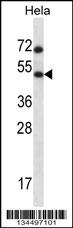 HSFX1 Antibody (Center) (Cat. #AP14550c) western blot analysis in Hela cell line lysates (35ug/lane).This demonstrates the HSFX1 antibody detected the HSFX1 protein (arrow).