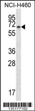 BEND4 Antibody (N-term) (Cat. #AP14883a) western blot analysis in NCI-H460 cell line lysates (35ug/lane).This demonstrates the BEND4 antibody detected the BEND4 protein (arrow).