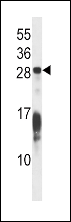 RAP1B Antibody (C-term) (Cat. #AP14852b) western blot analysis in Hela cell line lysates (35ug/lane).This demonstrates the RAP1B antibody detected the RAP1B protein (arrow).