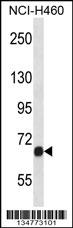 Mouse Fgfr1 Antibody (C-term) (Cat. #AP14840b) western blot analysis in NCI-H460 cell line lysates (35ug/lane).This demonstrates the Fgfr1 antibody detected the Fgfr1 protein (arrow).