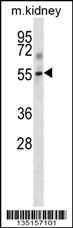 Mouse Tgfbr1 Antibody (Center) (Cat. #AP14778c) western blot analysis in mouse kidney tissue lysates (35ug/lane).This demonstrates the Tgfbr1 antibody detected the Tgfbr1 protein (arrow).