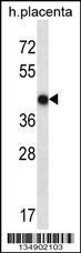 OR10V1 Antibody (C-term) (Cat. #AP14727b) western blot analysis in human placenta tissue lysates (35ug/lane).This demonstrates the OR10V1 antibody detected the OR10V1 protein (arrow).