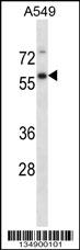 USP30 Antibody (N-term) (Cat. #AP14725a) western blot analysis in A549 cell line lysates (35ug/lane).This demonstrates the USP30 antibody detected the USP30 protein (arrow).