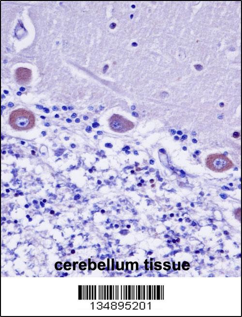 KDELR2 Antibody (C-term) (AP14724b)immunohistochemistry analysis in formalin fixed and paraffin embedded human cerebellum tissue followed by peroxidase conjugation of the secondary antibody and DAB staining.This data demonstrates the use of KDELR2 Antibody (C-term) for immunohistochemistry. Clinical relevance has not been evaluated.
