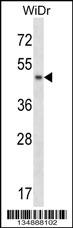 ANKS4B Antibody (Center) (Cat. #AP14720c) western blot analysis in WiDr cell line lysates (35ug/lane).This demonstrates the ANKS4B antibody detected the ANKS4B protein (arrow).