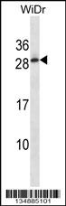 C11orf20 Antibody (C-term) (Cat. #AP14718b) western blot analysis in WiDr cell line lysates (35ug/lane).This demonstrates the C11orf20 antibody detected the C11orf20 protein (arrow).