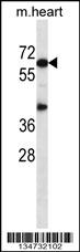 Mouse Akt1 Antibody (N-term) (Cat. #AP14703a) western blot analysis in mouse heart tissue lysates (35ug/lane).This demonstrates the Akt1 antibody detected the Akt1 protein (arrow).