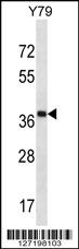 CLIP4 Antibody (Center) (Cat. #AP16009c) western blot analysis in Y79 cell line lysates (35ug/lane).This demonstrates the CLIP4 antibody detected the CLIP4 protein (arrow).