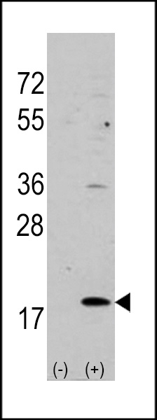 Western blot analysis of VILIP3 (arrow) using rabbit polyclonal VILIP3 Antibody (N-term) (Cat.#AP1563a). 293 cell lysates (2 ug/lane) either nontransfected (Lane 1) or transiently transfected with the VILIP3 gene (Lane 2) (Origene Technologies).