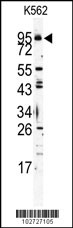 Western blot analysis of Mouse TLR6 Antibody (C-term) (Cat.# AP1506c) in K562 cell line lysates (35ug/lane). TLR6 (arrow) was detected using the purified Pab.