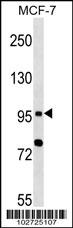 TLR6 Antibody (N11) (Cat. #AP1506b) western blot analysis in MCF-7 cell line lysates (35ug/lane).This demonstrates the TLR6 antibody detected the TLR6 protein (arrow).