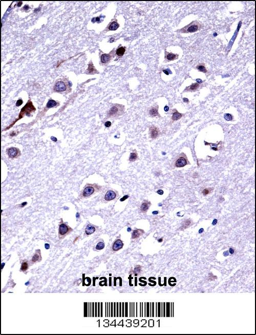 KIF16b Antibody (AP15010a)immunohistochemistry analysis in formalin fixed and paraffin embedded human brain tissue followed by peroxidase conjugation of the secondary antibody and DAB staining.This data demonstrates the use of KIF16b Antibody for immunohistochemistry. Clinical relevance has not been evaluated.