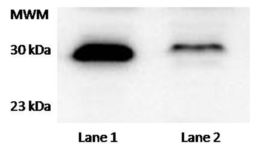 Western blot analysis of H1299 homo sapiens lymph node non-small cell lung cancer cells, whole cell extracts( lane 1) and MDA-MB-231 homo sapiens adenocarcinoma mammary gland cells, whole cell extracts( lane 2). Antibody raised against TTC33 sequence FGWKRKIGEKVSKVT of the protein NP_036514 was used at a 1:1000 dilution. Molecular weight marker (MWM) ColorPlus Prestained Protein Marker, Broad Range (7–175 kDa) (New England Biolabs, USA) (Data courtesy of Facultad de Medicina. Universidad Católica de Valencia “San Vicente Mártir”,C/Quevedo, 2 46001 Valencia, España.).