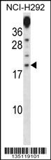 PRR15 Antibody (C-term) (Cat. #AP14978b) western blot analysis in NCI-H292 cell line lysates (35ug/lane).This demonstrates the PRR15 antibody detected the PRR15 protein (arrow).