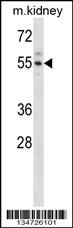 Mouse Acvr2a Antibody (N-term) (Cat. #AP14963a) western blot analysis in mouse kidney tissue lysates (35ug/lane).This demonstrates the Acvr2a antibody detected the Acvr2a protein (arrow).
