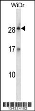 KLK12 Antibody (Center) (Cat. #AP14944c) western blot analysis in WiDr cell line lysates (35ug/lane).This demonstrates the KLK12 antibody detected the KLK12 protein (arrow).