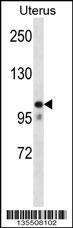 MOV10 Antibody (N-term) (Cat. #AP14933a) western blot analysis in human normal Uterus tissue lysates (35ug/lane).This demonstrates the MOV10 antibody detected the MOV10 protein (arrow).