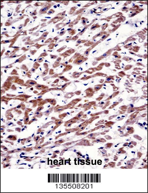 MOV10 Antibody (N-term) (AP14933a)immunohistochemistry analysis in formalin fixed and paraffin embedded human heart tissue followed by peroxidase conjugation of the secondary antibody and DAB staining.This data demonstrates the use of MOV10 Antibody (N-term) for immunohistochemistry. Clinical relevance has not been evaluated.