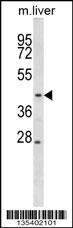 Mouse Map2k2 Antibody (N-term) (Cat. #AP14919a) western blot analysis in mouse liver tissue lysates (35ug/lane).This demonstrates the Map2k2 antibody detected the Map2k2 protein (arrow).