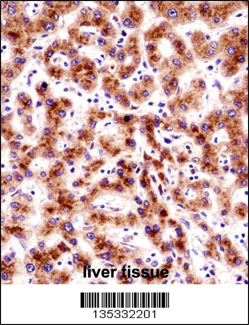 SEC61B Antibody (Center) (AP14910c)immunohistochemistry analysis in formalin fixed and paraffin embedded human liver tissue followed by peroxidase conjugation of the secondary antibody and DAB staining.This data demonstrates the use of SEC61B Antibody (Center) for immunohistochemistry. Clinical relevance has not been evaluated.