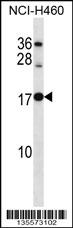RPL12 Antibody (Center) (Cat. #AP16275c) western blot analysis in NCI-H460 cell line lysates (35ug/lane).This demonstrates the RPL12 antibody detected the RPL12 protein (arrow).