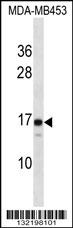 LIM2 Antibody (C-term) (Cat. #AP16239b) western blot analysis in MDA-MB453 cell line lysates (35ug/lane).This demonstrates the LIM2 antibody detected the LIM2 protein (arrow).