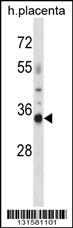 OR4K13 Antibody (N-term) (Cat. #AP16236a) western blot analysis in human placenta tissue lysates (35ug/lane).This demonstrates the OR4K13 antibody detected the OR4K13 protein (arrow).