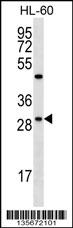 FMR1NB Antibody (N-term) (Cat. #AP16214a) western blot analysis in HL-60 cell line lysates (35ug/lane).This demonstrates the FMR1NB antibody detected the FMR1NB protein (arrow).