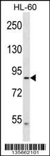 DNAH2 Antibody (N-term) (Cat. #AP16211a) western blot analysis in HL-60 cell line lysates (35ug/lane).This demonstrates the DNAH2 antibody detected the DNAH2 protein (arrow).