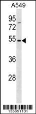 TM6SF1 Antibody (N-term) (Cat. #AP16209a) western blot analysis in A549 cell line lysates (35ug/lane).This demonstrates the TM6SF1 antibody detected the TM6SF1 protein (arrow).