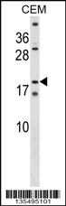 SSX4 Antibody (Center) (Cat. #AP16168c) western blot analysis in CEM cell line lysates (35ug/lane).This demonstrates the SSX4 antibody detected the SSX4 protein (arrow).