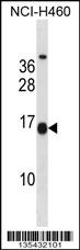 MSGN1 Antibody (Center) (Cat. #AP16154c) western blot analysis in NCI-H460 cell line lysates (35ug/lane).This demonstrates the MSGN1 antibody detected the MSGN1 protein (arrow).
