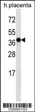OR5H2 Antibody (C-term) (Cat. #AP16087b) western blot analysis in human placenta tissue lysates (35ug/lane).This demonstrates the OR5H2 antibody detected the OR5H2 protein (arrow).