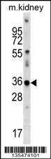 Mouse Cdkl4 Antibody (C-term) (Cat. #AP16075b) western blot analysis in mouse kidney tissue lysates (35ug/lane).This demonstrates the Cdkl4 antibody detected the Cdkl4 protein (arrow).