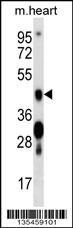 Mouse Camk4 Antibody (C-term) (Cat. #AP16069b) western blot analysis in mouse heart tissue lysates (35ug/lane).This demonstrates the Camk4 antibody detected the Camk4 protein (arrow).