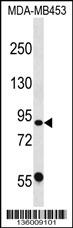 CAPN13 Antibody (C-term) (Cat. #AP16450b) western blot analysis in MDA-MB453 cell line lysates (35ug/lane).This demonstrates the CAPN13 antibody detected the CAPN13 protein (arrow).
