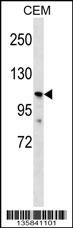 PKD2L1 Antibody (N-term) (Cat. #AP16416a) western blot analysis in CEM cell line lysates (35ug/lane).This demonstrates the PKD2L1 antibody detected the PKD2L1 protein (arrow).