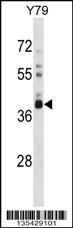 OR52L1 Antibody (C-term) (Cat. #AP16375b) western blot analysis in Y79 cell line lysates (35ug/lane).This demonstrates the OR52L1 antibody detected the OR52L1 protein (arrow).