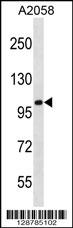 CCDC46 Antibody (N-term) (Cat. #AP16347a) western blot analysis in A2058 cell line lysates (35ug/lane).This demonstrates the CCDC46 antibody detected the CCDC46 protein (arrow).