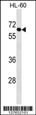 AIM1L Antibody (C-term) (Cat. #AP16345b) western blot analysis in HL-60 cell line lysates (35ug/lane).This demonstrates the AIM1L antibody detected the AIM1L protein (arrow).