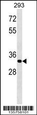ELOVL4 Antibody (C-term) (Cat. #AP16326b) western blot analysis in 293 cell line lysates (35ug/lane).This demonstrates the ELOVL4 antibody detected the ELOVL4 protein (arrow).