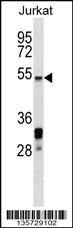 HSF5 Antibody (C-term) (Cat. #AP16315b) western blot analysis in Jurkat cell line lysates (35ug/lane).This demonstrates the HSF5 antibody detected the HSF5 protein (arrow).