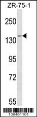 PAN2 Antibody (C-term) (Cat. #AP16665b) western blot analysis in ZR-75-1 cell line lysates (35ug/lane).This demonstrates the PAN2 antibody detected the PAN2 protein (arrow).