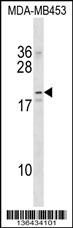 NKAIN2 Antibody (Center) (Cat. #AP16664c) western blot analysis in MDA-MB453 cell line lysates (35ug/lane).This demonstrates the NKAIN2 antibody detected the NKAIN2 protein (arrow).