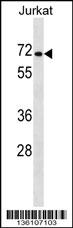 PRODH2 Antibody (Center) (Cat. #AP16627c) western blot analysis in Jurkat cell line lysates (35ug/lane).This demonstrates the PRODH2 antibody detected the PRODH2 protein (arrow).