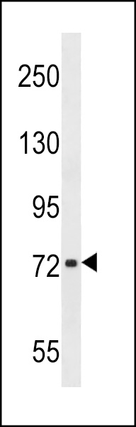 CHADL Antibody (Center) (Cat. #AP16613c) western blot analysis in T47D cell line lysates (35ug/lane).This demonstrates the CHADL antibody detected the CHADL protein (arrow).